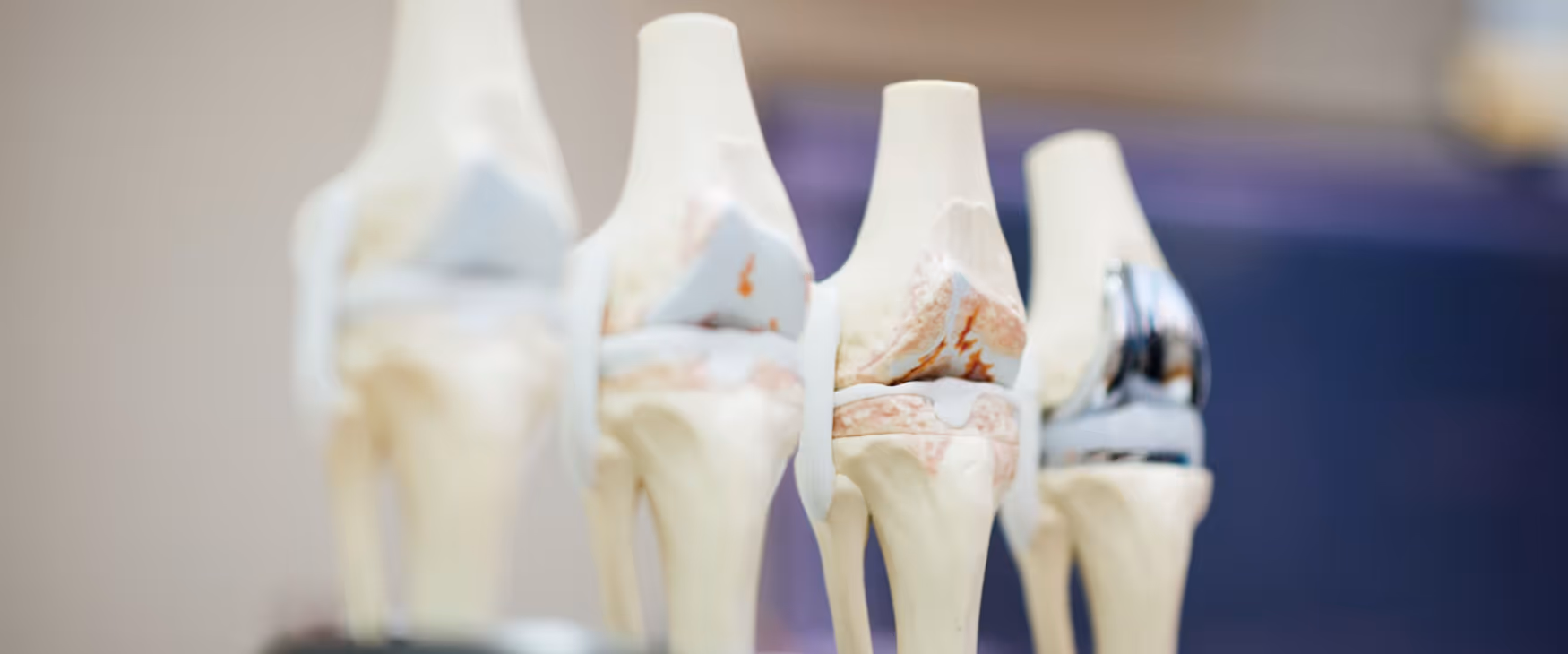 Treatment of Common Orthopedic Conditions
